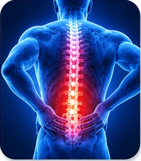 Back Pain