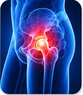 Hip Pain