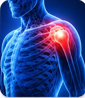 Shoulder Pain