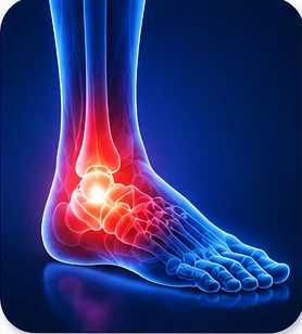 Sprain and Strain